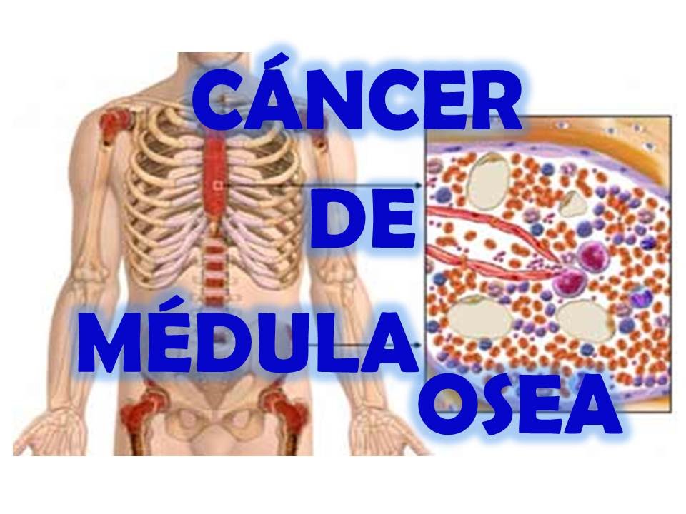 La Fundación Ramón Areces financiará un proyecto de investigación para la lucha contra el cáncer de médula ósea